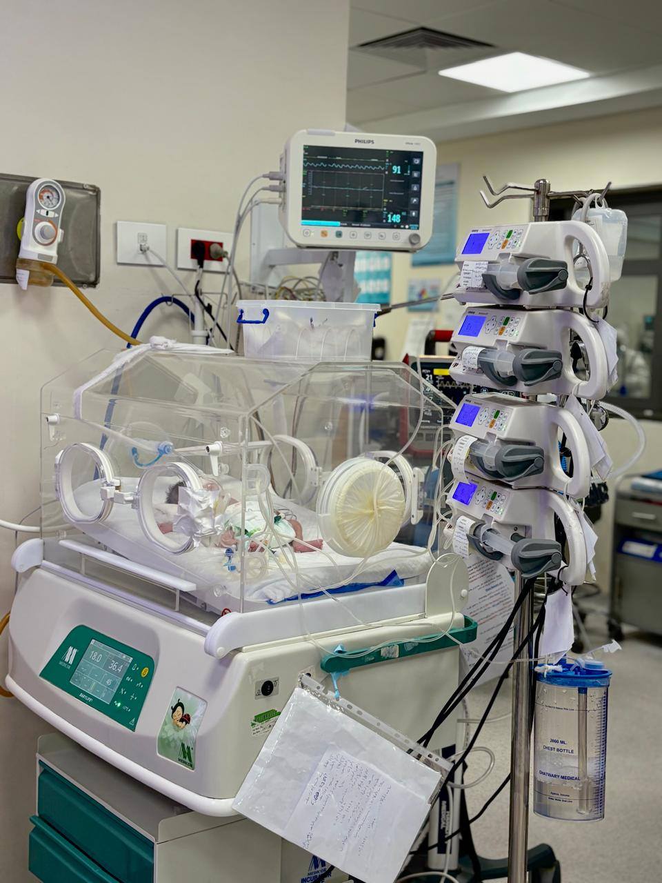 مليون خدمة طبية وعلاجية بمستشفى فايد التخصصي منذ بدء التشغيل 