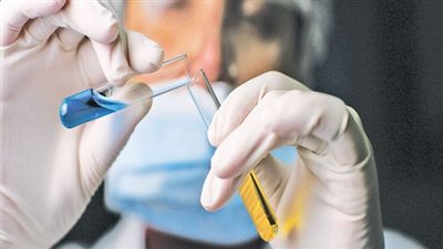 عقار جديد قد ينهي معاناة مرضى إدمان الكحوليات