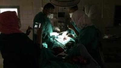 إجراء عملية 