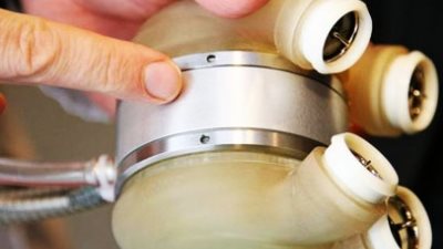 شركة كارما الفرنسية تقوم بتركيب قلب صناعي لثاني مريض