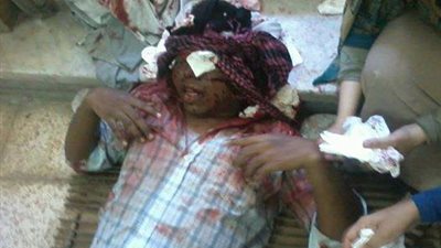 وفاة طالب الهندسة المصاب في أحداث 