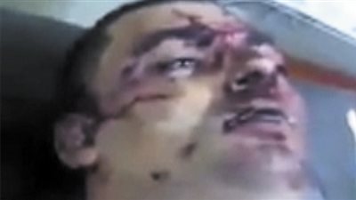 الداخلية : وفاة مواطن بمنطقة المطرية متأثرا بجراحه