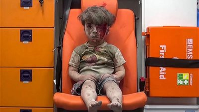 وفاة شقيق الطفل 