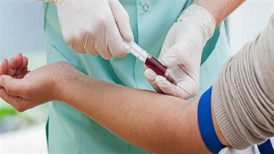 تقنية لفحص الدم تشخص السرطان بطريقة أسرع