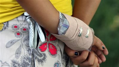 عناق كاد يكلف صاحبه غرامة 127 ألف دولار