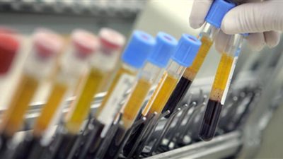 اختبار دم يحذرك من أمراض القلب