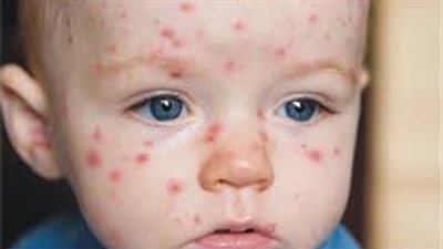 دعوة لإضافة 