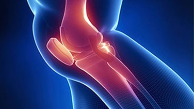 للمرة الأولى.. استخراج عينة من غضروف الأنف لإصلاح تلف الركبة