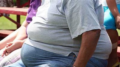 باحث بريطاني يكتشف 115 جينًا مرتبطًا بالبدانة