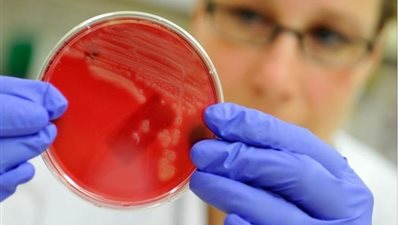 تحذير: من تزايد الأمراض الناتجة عن تسمم الدم