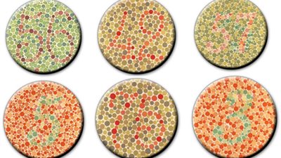 علماء أمريكيون يتوصلون إلى الخلل الجينى المسئول عن 