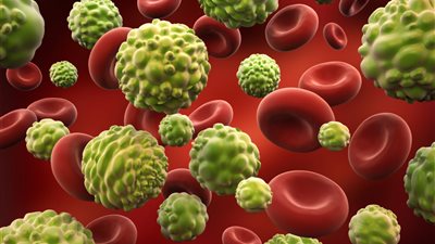 دراسة تكشف عن 22 نوعًا من السرطان تصيب صاحبها لأسباب وراثية