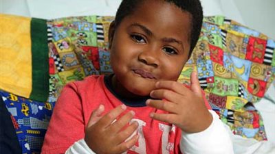 بالفيديو .. طفل بعمر 8 سنوات يخضع لعملية جراحية ناجحة لزراعة يدين 