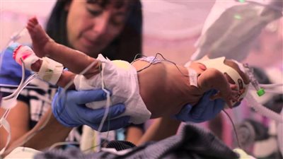 ولادة جنين بعد موت أمه بـ55 يوما