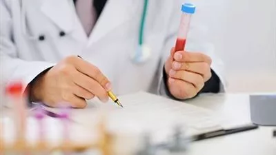 الأمم المتحدة تحذر من تفشي وباء الإيدز