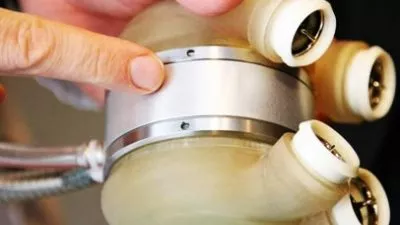 شركة كارما الفرنسية تقوم بتركيب قلب صناعي لثاني مريض