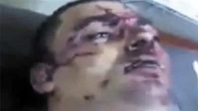 الداخلية : وفاة مواطن بمنطقة المطرية متأثرا بجراحه