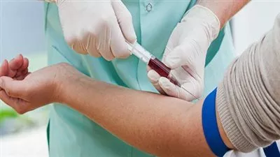 تقنية لفحص الدم تشخص السرطان بطريقة أسرع