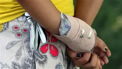 عناق كاد يكلف صاحبه غرامة 127 ألف دولار