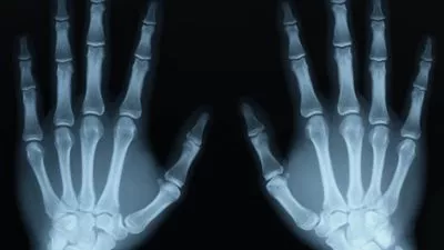 علماء يطورون كاميرا تساعد في رؤية جسم الإنسان من الداخل