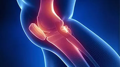 للمرة الأولى.. استخراج عينة من غضروف الأنف لإصلاح تلف الركبة