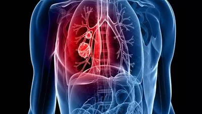 النظام الغذائى الغنى بالألياف يسهم في الوقاية من أمراض الرئة