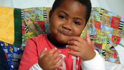 بالفيديو .. طفل بعمر 8 سنوات يخضع لعملية جراحية ناجحة لزراعة يدين 