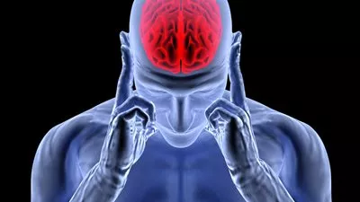 علماء يكشفون الجين المسؤول عن الجلطة الدماغية